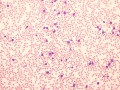 Acute T cell leukemia (T-ALL, dog)