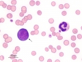 AML-M6 (cat)