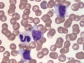 GL-CLL
