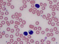B-CLL (dog)