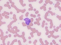 Suspect GL lymphoma (horse)