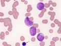 AML-M5 (cat)