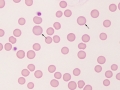 AML-M5 (cat)