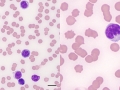 CLL (horse)