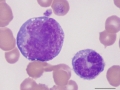 Promonocyte