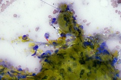 Liver