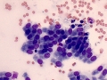 Gall bladder cells