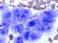 Vacuolar change (glycogen) (DQ)