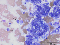 Lymphoma of granular lymphocytes (cat)