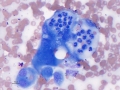 Mesothelial cells