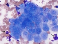 Hepatocytes with lipofuscin
