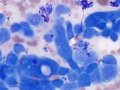 Mesothelial cells