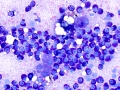 Mast cell tumor (cat)