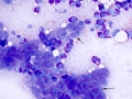 Mast cell tumor (cat)