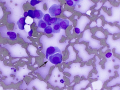 Plasma cell tumor (cat)