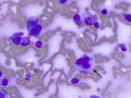 Plasma cell tumor (cat)