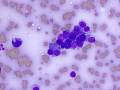 Plasma cell tumor (cat)