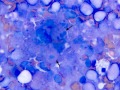 T cell tumor and necrosis