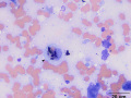 Bile cast in a macrophage