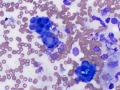 Biliary epithelium