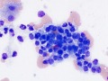 Biliary epithelium (vacuolated)
