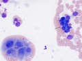 Biliary epithelium