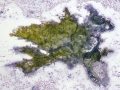 Bile aggregate