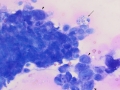 Carcinoma (feline)