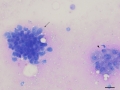 Carcinoma (feline)