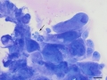Carcinoma (feline)