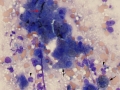 Copper & inflammation