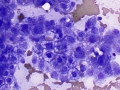 Vacuolar change (glycogen)