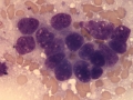 Hepatoblastoma (horse)