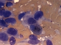 Hepatoblastoma (horse)
