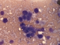 Hepatoblastoma (horse)