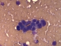 Hepatoblastoma (horse)