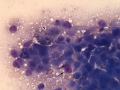 Hepatoblastoma (horse)