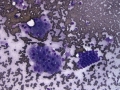 Hepatocytes & biliary epithelium (DQ)