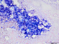 Lipidosis (dog)