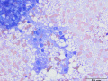 Lipidosis (dog)