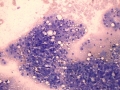 Lipidosis (cat)