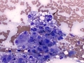 Lipidosis (cat)