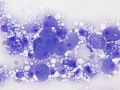 Lipidosis (DQ, cat)
