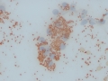 Copper (rubeanic stain)
