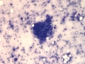 Carcinoma (feline)