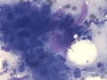 Carcinoma (feline)