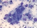 Carcinoma (feline)