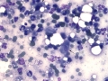 Carcinoma (feline)