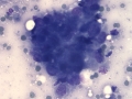 Carcinoma (feline)