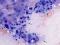 Suspect Kupffer cells & mast cells